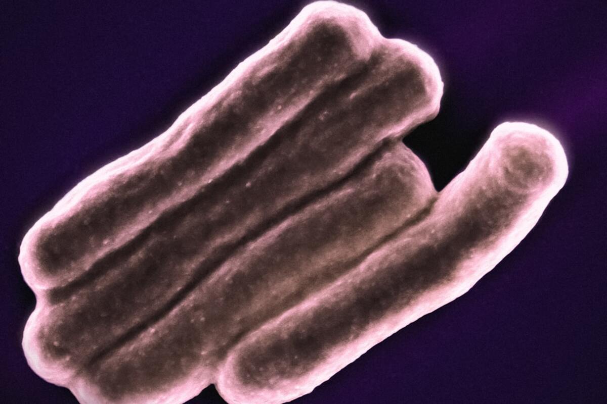 Visual representation of the intricate relationship between the human microbiome and health.